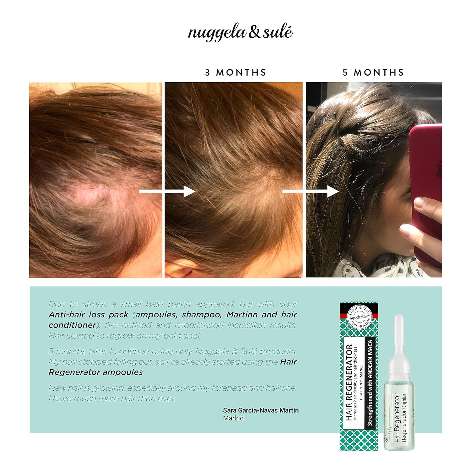 Nuggela & Sulé Haarspülungsampullen erhöhen die Haardichte und -stärke. Nuggela Haarpflege