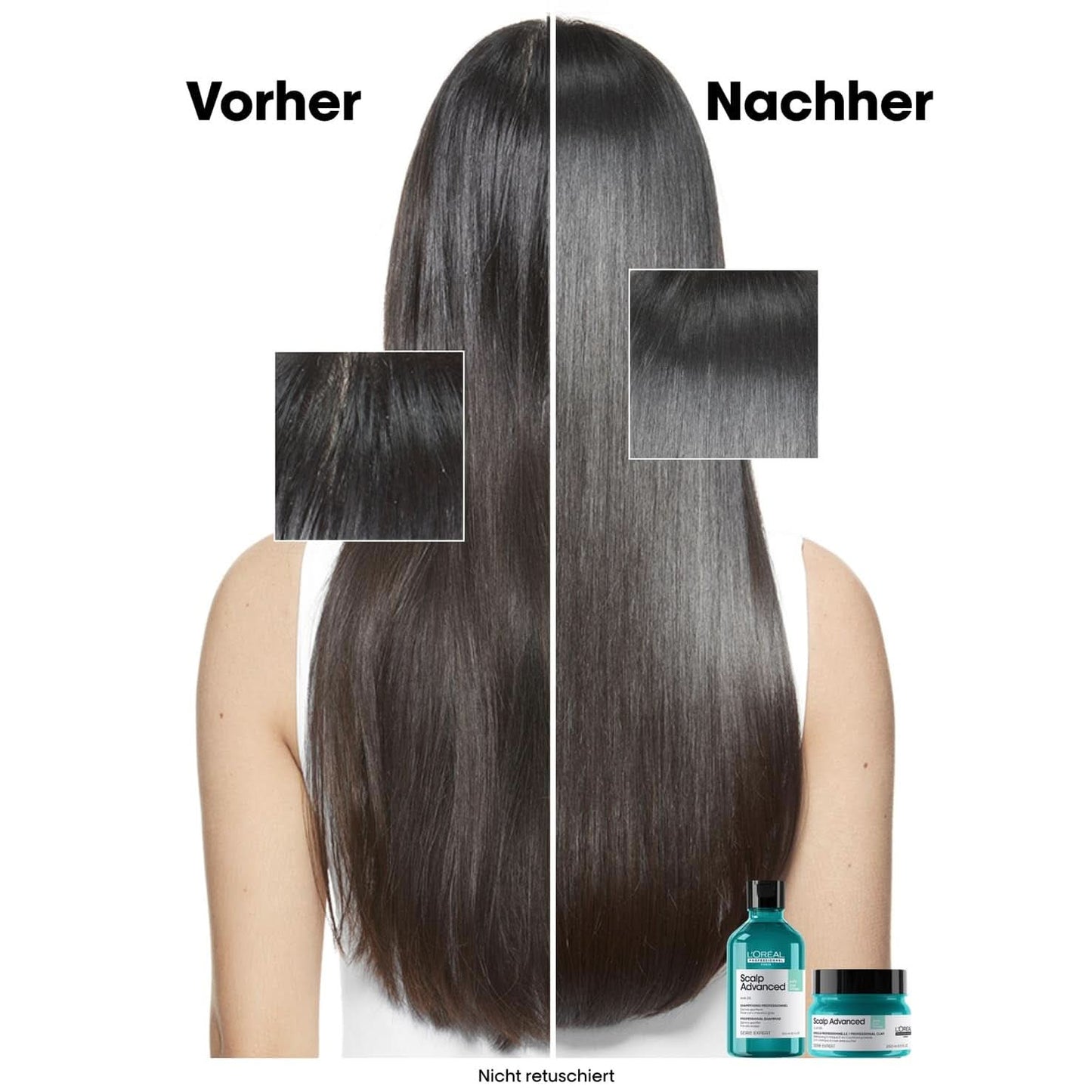 L'Oréal Professionnel Reinigungsshampoo für fettige Kopfhaut, 300 ml, Naty Shop Dusche und Bad