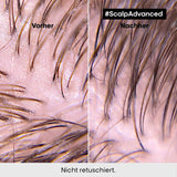L'Oréal Professionnel Reinigungsshampoo für fettige Kopfhaut, 300 ml, Naty Shop Dusche und Bad