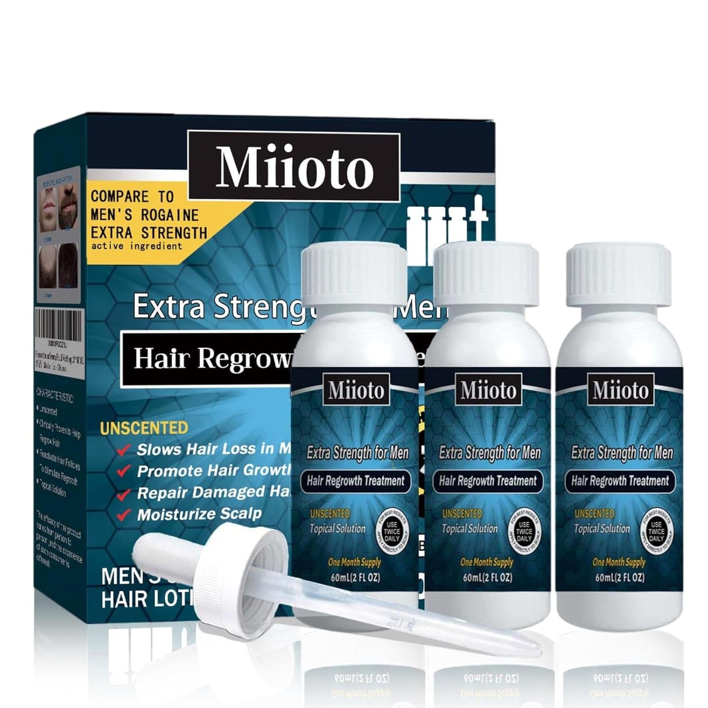 Miioto Haarwachstumsserum, Haarwachstumsprodukt für Männer, Haarwachstumsserum, Kopfhautpflege, fördert dickeres Haar, nährt die Kopfhaut und beugt Haarausfall vor, 3 x 60 ml Haarpflege Naty Shop Standardtitel