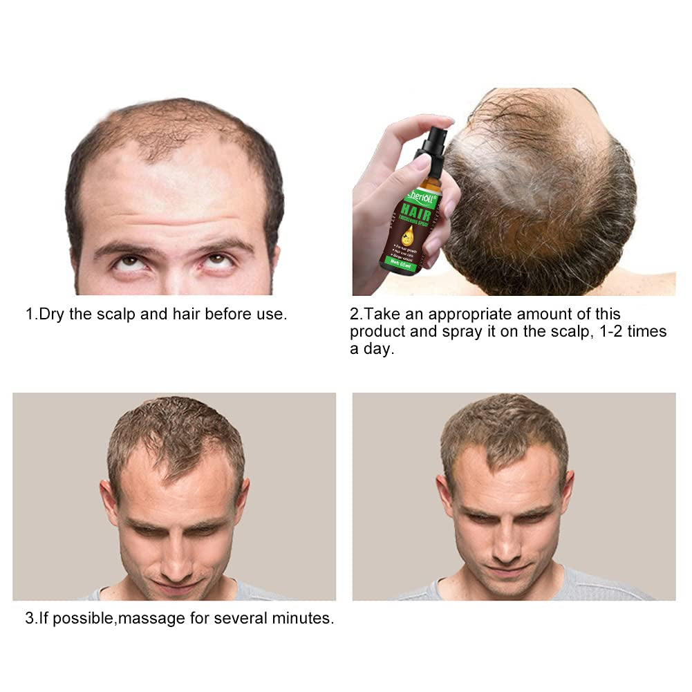 Haarwachstum, Anti-Haarausfall, Haarwachstumsspray, Haarausfall und Haarbehandlung, für dünner werdendes Haar, fördert dickeres, volleres und schnelleres Haarwachstum, 60 ml Haarpflege Naty Shop