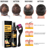 Advanced Hair Growth Treatment Kit 30 ml 2PCS Haarwachstumsspray Haarwachstumsroller und Essenz-Set Haarwachstumsserum Anti-Haarausfall Advanced Hair Growth Serum Haarpflege Naty Shop