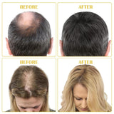 Bio-Haarwachstumsöl 5 % – Lösung zur äußerlichen Anwendung – Haarwachstum und -verdichtung – Für männlichen Haarausfall und dünner werdendes Haar – Reaktiviert schrumpfende Follikel – Präziser Pumpspender, 60 ml Haarpflege Naty Shop