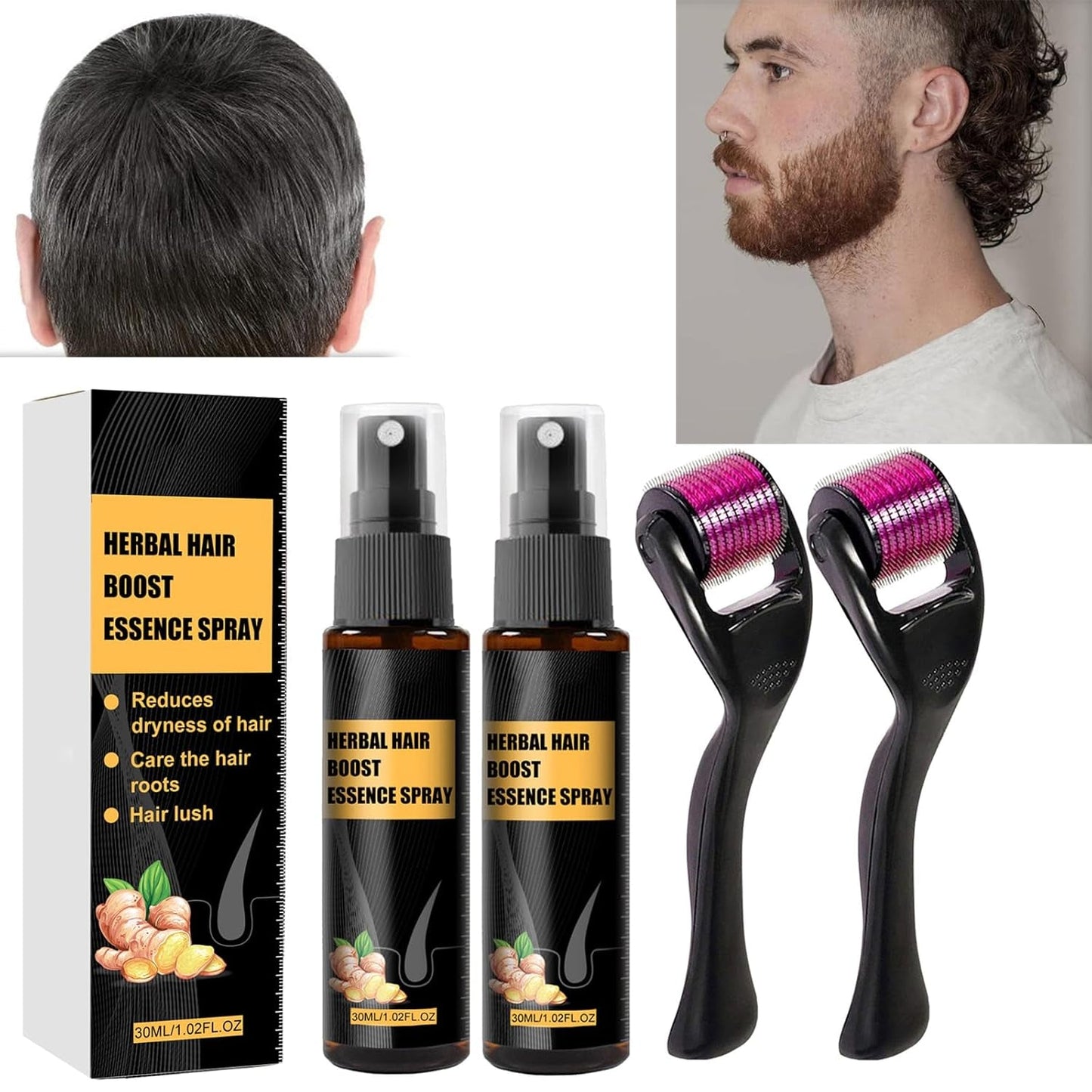Advanced Hair Growth Treatment Kit 30 ml 2PCS Haarwachstumsspray Haarwachstumsroller und Essenzset Haarwachstumsserum Anti-Haarausfall Advanced Hair Growth Serum Haarpflege Naty Shop Standardtitel