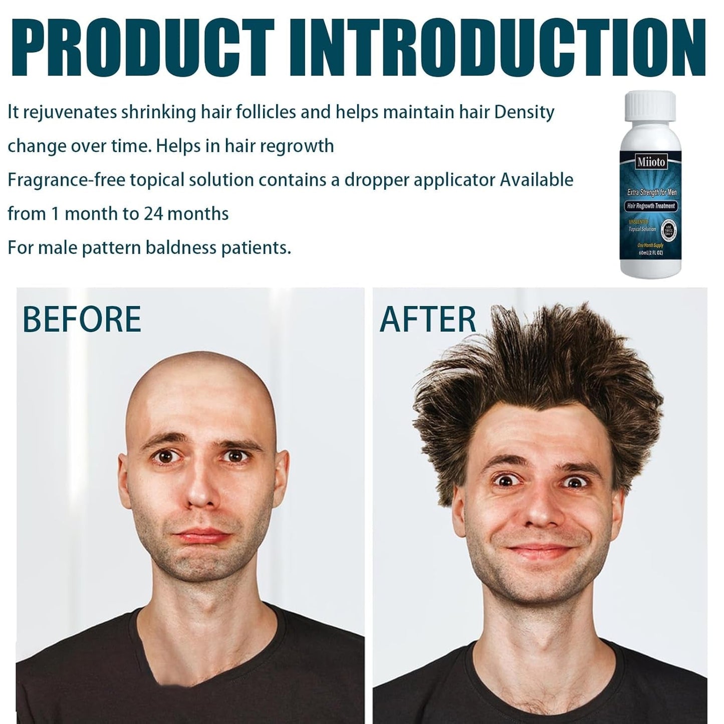 Miioto Haarwachstumsserum für Männer, Haarwachstumsprodukt, Haarwachstum, Haarserum, Kopfhautpflege, fördert dickeres Haar, nährt die Kopfhaut, verhindert Haarausfall, 3 x 60 ml, Haarpflege, Naty Shop