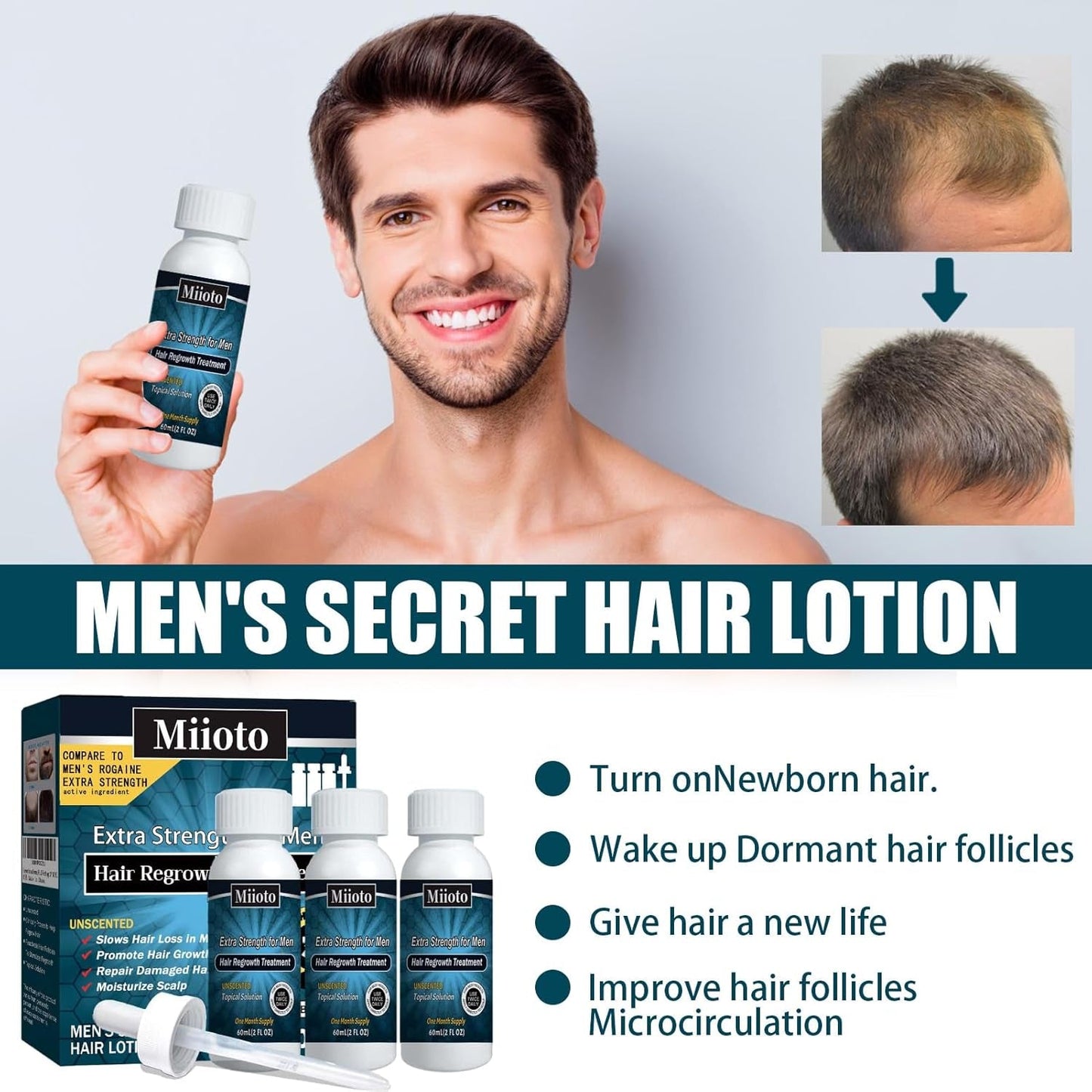 Miioto Haarwachstumsserum für Männer, Haarwachstumsprodukt, Haarwachstum, Haarserum, Kopfhautpflege, fördert dickeres Haar, nährt die Kopfhaut, verhindert Haarausfall, 3 x 60 ml, Haarpflege, Naty Shop