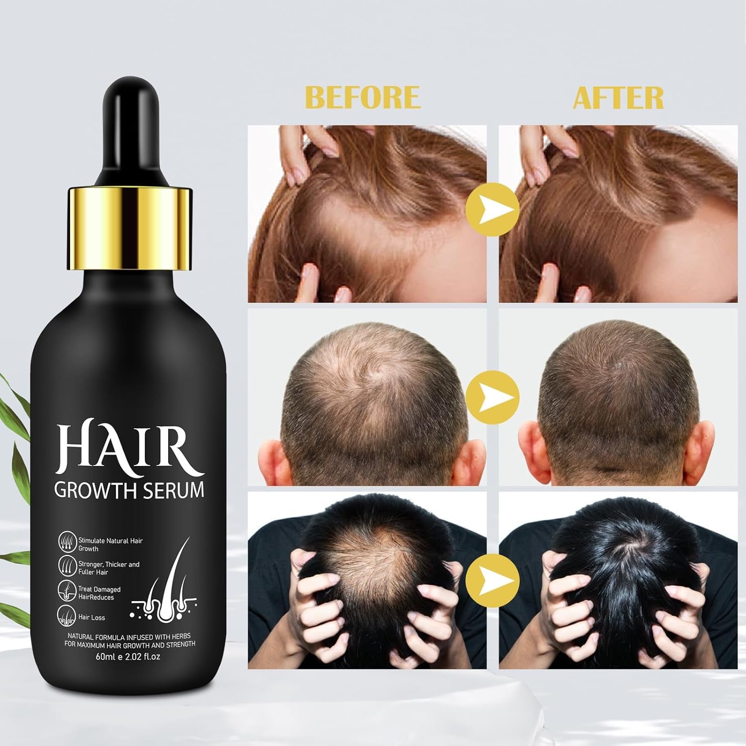 Bio-Haarwachstumsöl 5 % – Lösung zur äußerlichen Anwendung – Haarwachstum und -verdichtung – Für männlichen Haarausfall und dünner werdendes Haar – Reaktiviert schrumpfende Follikel – Präziser Pumpspender, 60 ml Haarpflege Naty Shop