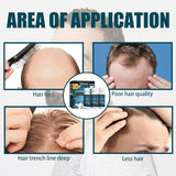 Miioto Haarwachstumsserum für Männer, Haarwachstumsprodukt, Haarwachstum, Haarserum, Kopfhautpflege, fördert dickeres Haar, nährt die Kopfhaut, verhindert Haarausfall, 3 x 60 ml, Haarpflege, Naty Shop
