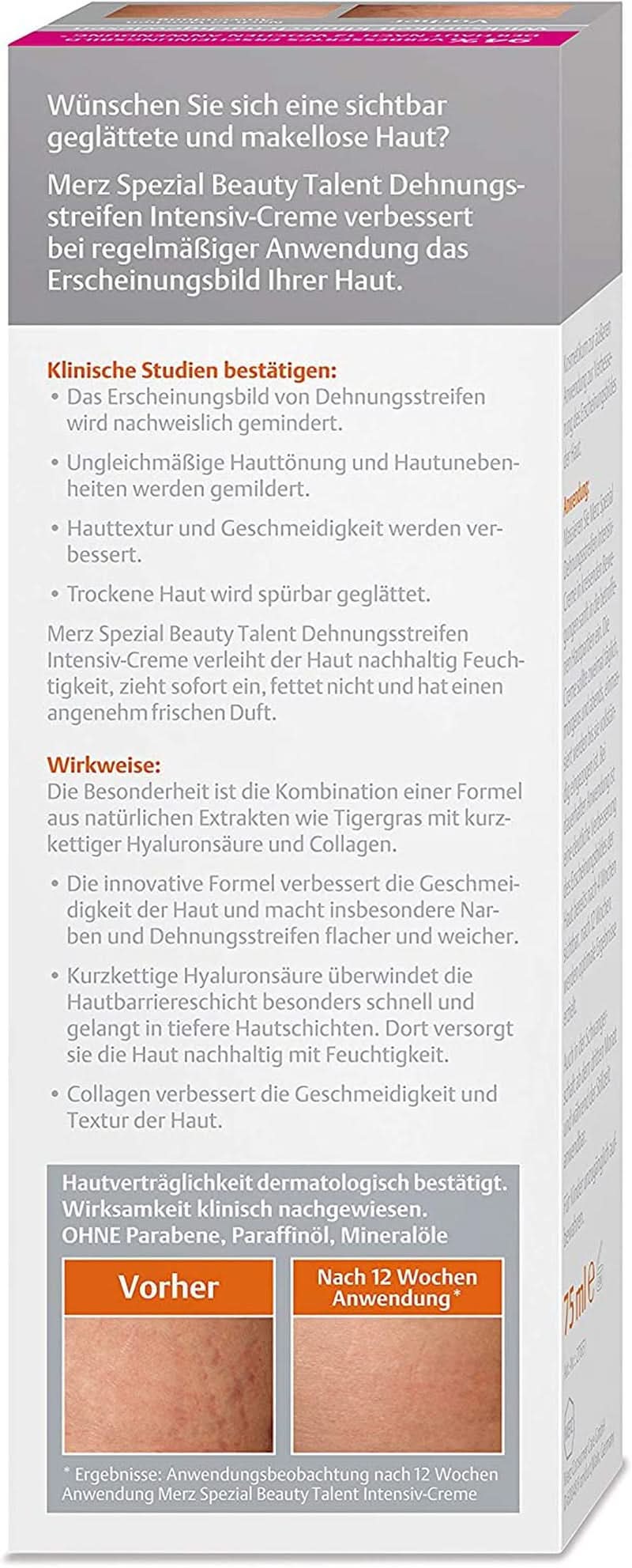 Merz Spezial, Intensivcreme gegen Dehnungsstreifen, 75 ml Kosmetik und Beauty Naty Shop