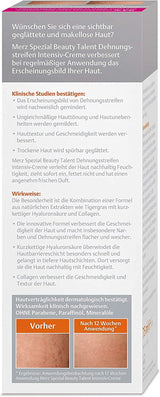 Merz Spezial, Intensivcreme gegen Dehnungsstreifen, 75 ml Kosmetik und Beauty Naty Shop