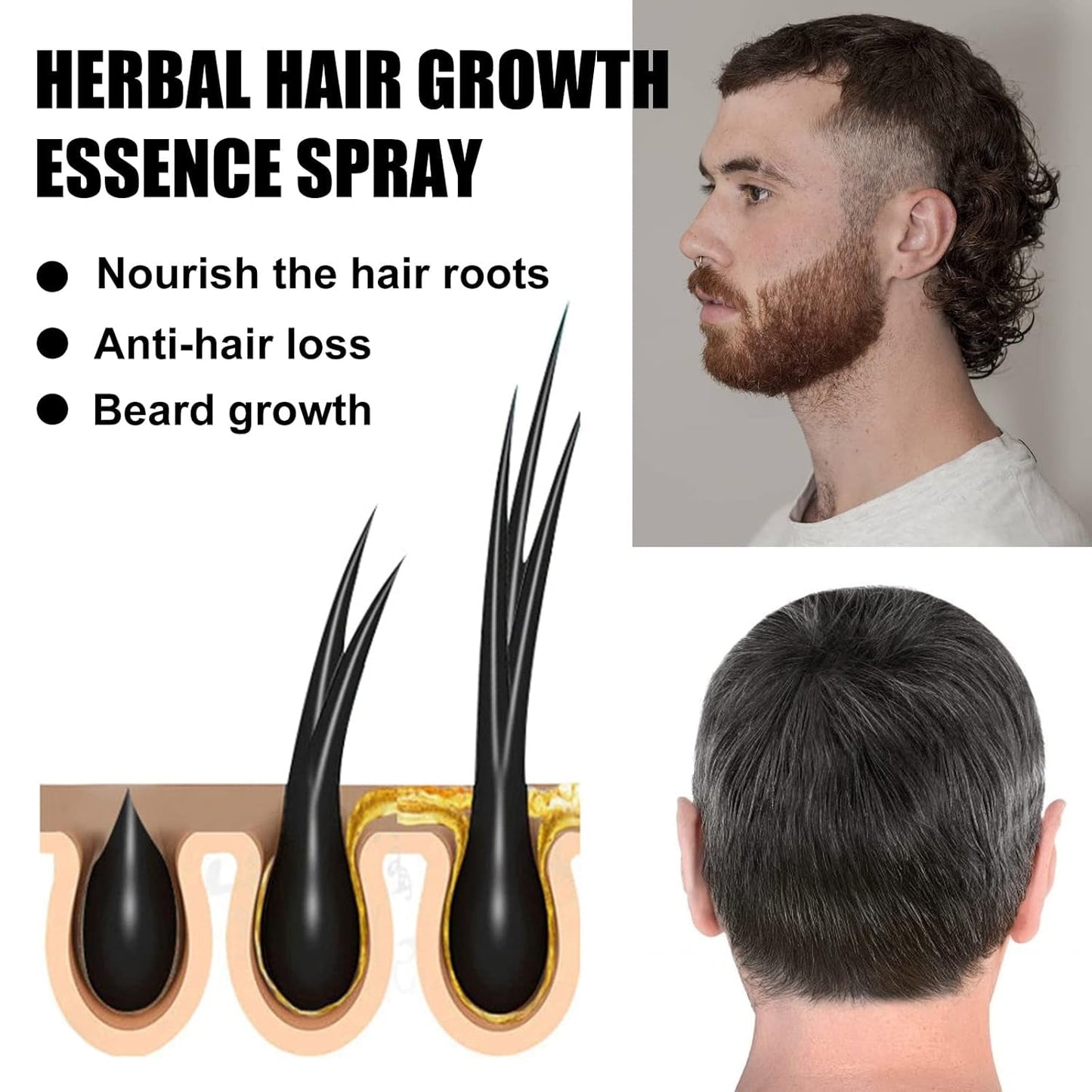 Advanced Hair Growth Treatment Kit 30 ml 2PCS Haarwachstumsspray Haarwachstumsroller und Essenz-Set Haarwachstumsserum Anti-Haarausfall Advanced Hair Growth Serum Haarpflege Naty Shop
